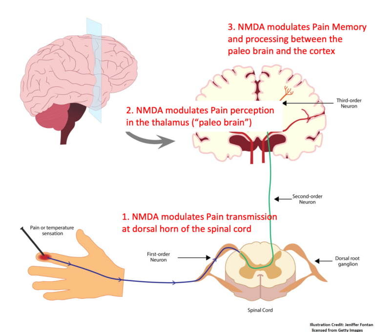 Understanding Chronic Pain